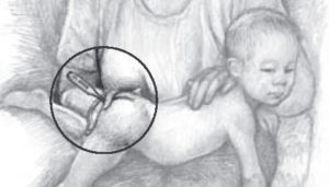 Parent gently inserting thermometer into the anus with infant on their belly