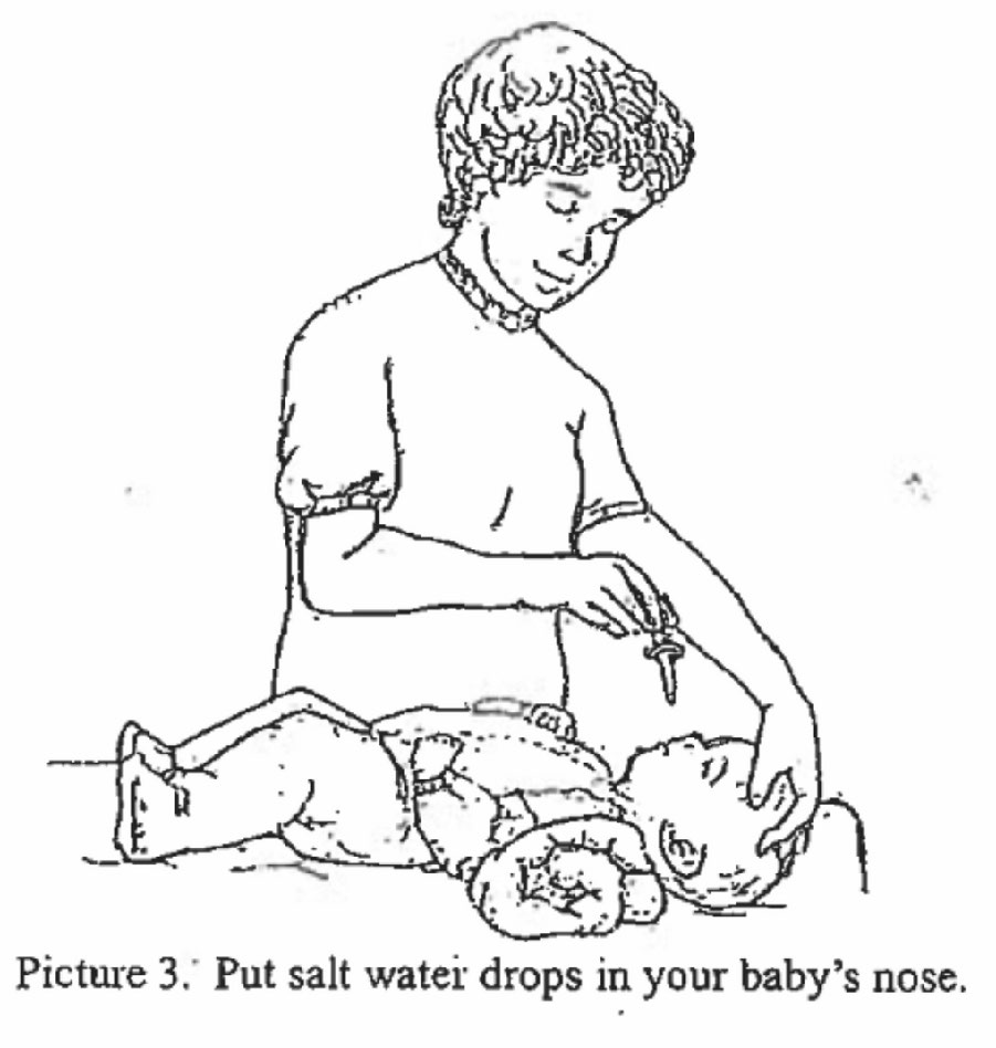 Picture 3. Put Salt Water Drops in Your Baby's Nose. Illustration of woman standing over baby gently dropping in salt water drops.